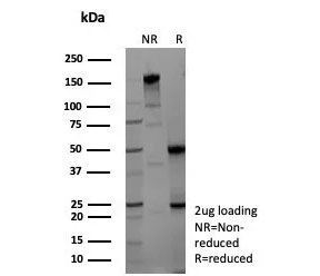 SDS-PAGE analysis of purified, BSA-free Gamma Enolase antibody (clone ENO2/9047) as confirmation of integrity and purity.