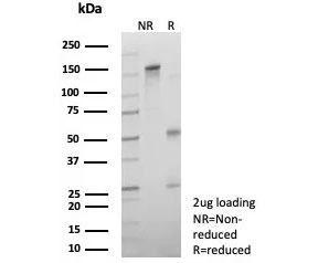 SDS-PAGE analysis of purified, BSA-free recombinant Androgen Receptor V7 antibody (clone DHTR.V7/9394R) as confirmation of integrity and purity.