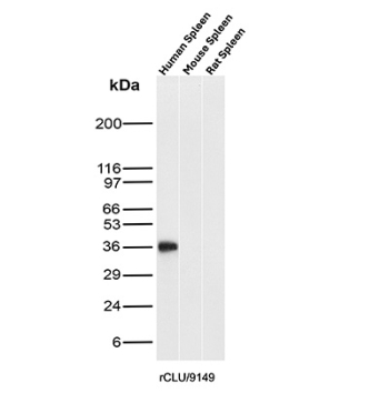 Clusterin Antibody Spleen WB. Western blot analysis of human spleen, mouse spleen, and rat spleen tissue lysates using Clusterin antibody. The recombinant antibody clone rCLU/9149 detects a band at approximately 36-39 kDa, consistent with the predicted molecular weight of the processed alpha and beta subunits of Clusterin / CLU. Detection across spleen samples highlights expression of this secreted chaperone protein in immune-rich lymphoid tissue, aligning with its role in extracellular protein stabilization and regulation within the immune microenvironment.