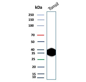 Clusterin Antibody Tonsil WB. Western blot analysis of human tonsil tissue lysate using Clusterin antibody. The recombinant antibody clone rCLU/9149 detects a strong band at approximately 36-39 kDa, consistent with the predicted molecular weight of the processed alpha and beta subunits of Clusterin / CLU. Robust signal in tonsil reflects expression of this secreted chaperone protein in immune-rich lymphoid tissue, aligning with its role in extracellular protein stabilization and immune microenvironment regulation.