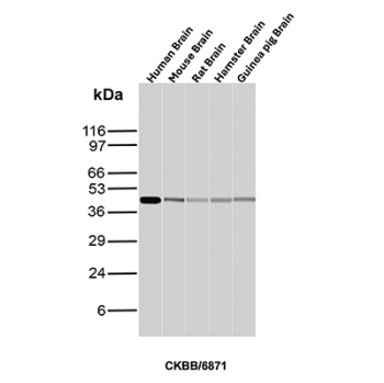CK-BB Antibody Multi-Species Brain WB. Western blot analysis of Human Brain, Mouse Brain, Rat Brain, Hamster Brain and Guinea pig Brain tissue lysates using CK-BB antibody (clone CKBB/6871). Predicted molecular weight ~43 kDa.
