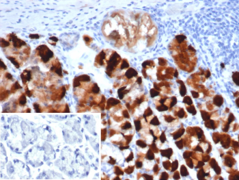 CK-BB Antibody Human Stomach Tissue IHC. Immunohistochemistry staining of FFPE human stomach tissue with CK-BB antibody (clone CKBB/6871). Inset: PBS used in place of primary Ab (secondary Ab negative control). HIER: boil tissue sections in pH 9 10mM Tris with 1mM EDTA for 20 min and allow to cool before testing.