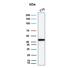 Western blot testing of human Y79 cell lysate using recombinant Creatine kinase B antibody (clone CKBB/8306). Predicted molecular weight ~43 kDa.