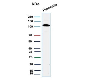 E-cadherin Antibody for WB in human placental tissue. Western blot analysis of Cadherin 1 / CDH1 expression using clone CDH1/9226R antibody, showing a band near the predicted molecular weight of E-cadherin. E-cadherin is synthesized as a precursor and undergoes glycosylation, resulting in an apparent molecular weight typically observed between approximately 80-120 kDa, with the precursor form near 135 kDa. The detected band is consistent with mature glycosylated E-cadherin associated with polarized epithelial tissue structure.