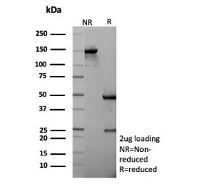 SDS-PAGE analysis of purified, BSA-free recombinant Cadherin 1 antibody (rCDH1/6769) as confirmation of integrity and purity.