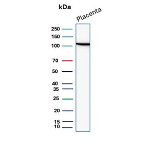E-cadherin Antibody for WB in human placental tissue. Western blot analysis of Cadherin 1 / CDH1 expression using clone CDH1/9615R antibody, showing a band near the predicted molecular weight of E-cadherin. E-cadherin is synthesized as a precursor and undergoes glycosylation, resulting in an apparent molecular weight typically observed between approximately 80-120 kDa, with the precursor form near 135 kDa. The detected band is consistent with mature glycosylated E-cadherin, and reduced expression of CDH1 is commonly associated with epithelial-to-mesenchymal transition in disease contexts.