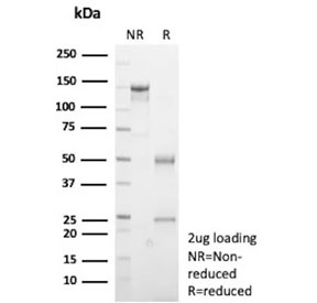 SDS-PAGE analysis of purified, BSA-free recombinant E-Cadherin antibody (clone rCDH1/9615) as confirmation of integrity and purity.