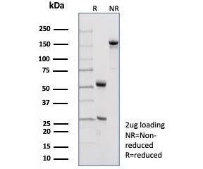 SDS-PAGE analysis of purified, BSA-free Pan-Cadherin antibody (clone Pan-CAD/8019) as confirmation of integrity and purity.