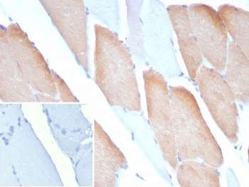 Immunohistochemistry analysis of MYH7 / Myosin 7 antibody (clone MYH7/9183) in human skeletal muscle tissue. FFPE human skeletal muscle section shows cytoplasmic brown chromogenic staining in a subset of muscle fibers consistent with type I slow-twitch fiber expression of MYH7, while adjacent fibers display weaker or minimal staining and nuclei appear blue. The inset shows PBS used in place of primary antibody as a negative control with no specific staining observed.