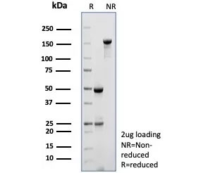 SDS-PAGE analysis of purified, BSA-free Myosin 7 antibody (clone MYH7/9184) as confirmation of integrity and purity.