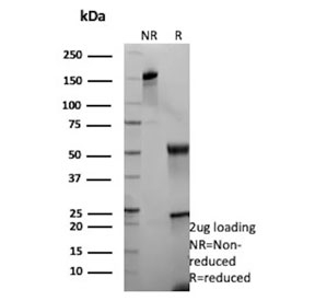 SDS-PAGE analysis of purified, BSA-free recombinant KRT13 antibody (clone rKRT13/9623) as confirmation of integrity and purity.