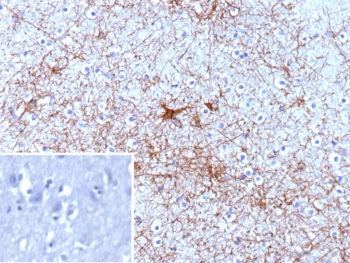 IHC staining of FFPE human prostate carcinoma with GFAP antibody (clone GFAP/9421). Inset: PBS used in place of primary Ab (secondary Ab negative control). HIER: boil tissue sections in pH 9 10mM Tris with 1mM EDTA for 20 min and allow to cool before testing.