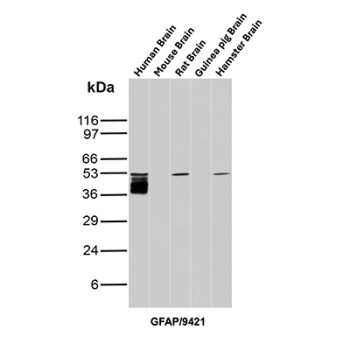 GFAP Antibody Brain Tissue WB. Western blot analysis of human brain, mouse brain, rat brain, guinea pig brain, and hamster brain tissue lysates using GFAP Antibody clone GFAP/9421. Multiple closely migrating bands are detected between approximately 40-50 kDa in human brain lysate, with additional bands of similar molecular weight observed in rat and hamster brain samples, consistent with Glial fibrillary acidic protein / GFAP, a major astrocytic intermediate filament protein involved in maintenance of neural cytoskeletal architecture. The stacked banding pattern in the human brain sample likely reflects a combination of GFAP isoforms and partial proteolytic processing products commonly encountered in brain tissue extracts.