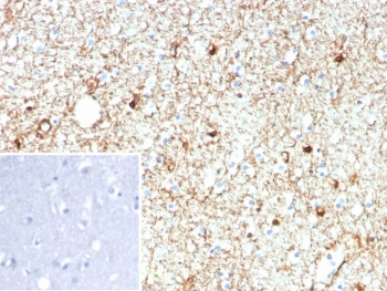 IHC staining of FFPE human brain tissue with recombinant GFAP antibody (clone rGFAP/9150). Inset: PBS used in place of primary Ab (secondary Ab negative control). HIER: boil tissue sections in pH 9 10mM Tris with 1mM EDTA for 20 min and allow to cool before testing.