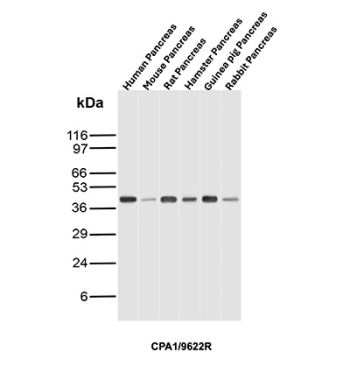 Carboxypeptidase A1 Antibody Multi-Species Pancreas WB. Western blot analysis of Carboxypeptidase A1 / CPA1 across multiple species pancreas tissue lysates using rabbit monoclonal Carboxypeptidase A1 antibody, clone CPA1/9622R. Lanes show human pancreas, mouse pancreas, rat pancreas, hamster pancreas, guinea pig pancreas, and rabbit pancreas. A band is detected at approximately 45 kDa in each species, consistent with the predicted molecular weight of CPA1, demonstrating conserved expression of this pancreatic digestive enzyme across mammalian species.