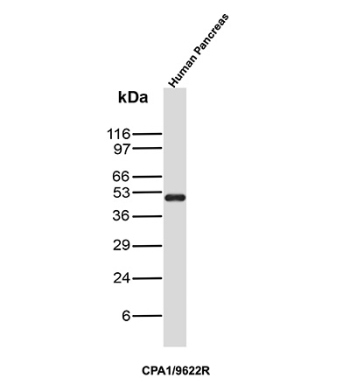 Carboxypeptidase A1 Antibody Pancreas WB. Western blot analysis of Carboxypeptidase A1 / CPA1 in human pancreas tissue lysate using rabbit monoclonal Carboxypeptidase A1 antibody, clone CPA1/9622R. A band is detected at approximately 45 kDa, consistent with the predicted molecular weight of CPA1, reflecting its expression as a digestive enzyme produced by pancreatic acinar cells.