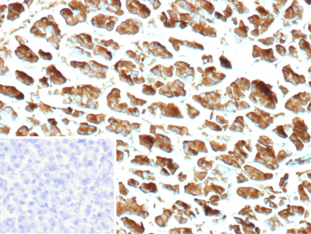 Carboxypeptidase A1 Antibody Pancreas IHC. Immunohistochemistry of Carboxypeptidase A1 / CPA1 in FFPE human pancreas tissue using recombinant rabbit monoclonal Carboxypeptidase A1 antibody, clone CPA1/9622R. Strong HRP-DAB brown cytoplasmic staining highlights pancreatic acinar cells, consistent with the enzymeâs role in digestive protein processing, while nuclei are counterstained blue. The staining pattern shows robust and uniform labeling of acinar cell populations with minimal background signal. Inset: PBS was used in place of primary antibody as a negative control to confirm specificity of staining. Heat induced epitope retrieval was performed by boiling tissue sections in pH 9 10 mM Tris with 1 mM EDTA for 20 min followed by cooling prior to staining.