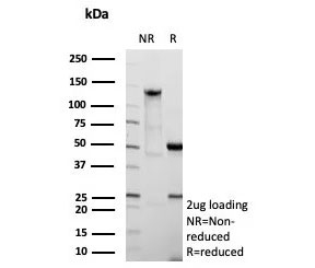 SDS-PAGE analysis of purified, BSA-free Fatty Acid Binding Protein 4 antibody (clone FABP4/9086R) as confirmation of integrity and purity.