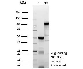 SDS-PAGE analysis of purified, BSA-free recombinant Myoblast determination protein 1 antibody (clone MYOD1/9405R) as confirmation of integrity and purity.