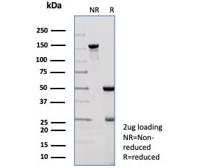 SDS-PAGE analysis of purified, BSA-free Pancreatic lipase antibody (clone PNLIP/8913) as confirmation of integrity and purity.