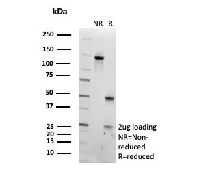 SDS-PAGE analysis of purified, BSA-free Pancreatic triacylglycerol lipase antibody (clone PNLIP/9042) as confirmation of integrity and purity.