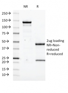 SDS-PAGE analysis of purified, BSA-free Transglutaminase 2 antibody (clone SPM358) as confirmation of integrity and purity.