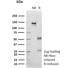 SDS PAGE analysis of purified recombinant S100A1 antibody (clone S100A1/9244R) as confirmation of integrity and purity.