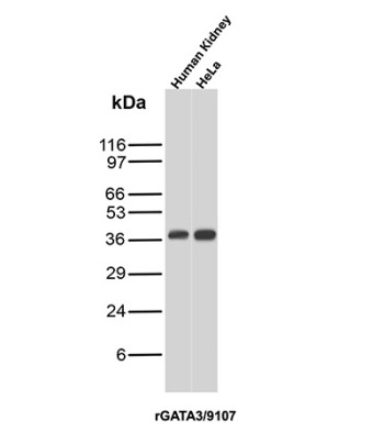 GATA3 Antibody Human Kidney and HeLa WB. Western blot analysis of human kidney and HeLa cell lysates using recombinant GATA3 Antibody / GATA Binding Protein 3 Antibody clone rGATA3/9107. A distinct band is detected at approximately 40 kDa, consistent with reported migration patterns of GATA binding protein 3 / GATA3, a zinc finger transcription factor involved in epithelial differentiation and T-cell lineage regulation.