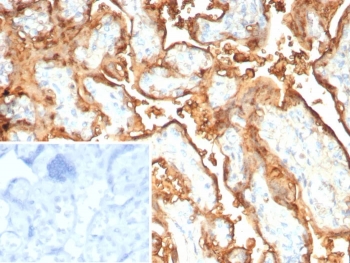 S100P Antibody Recombinant Mouse MAb rS100P/9254 in human placental tissue. Immunohistochemistry staining of FFPE human placenta demonstrates cytoplasmic staining in trophoblastic epithelial cells consistent with expression of S100 calcium binding protein P / S100P, also known as migration inducing gene 9 (MIG9). Brown chromogenic signal highlights S100P-positive trophoblast layers within the placental tissue while surrounding stromal elements show comparatively weaker staining. The inset shows PBS used in place of primary antibody as a secondary-only negative control. Heat-induced epitope retrieval was performed by boiling tissue sections in pH 9 Tris buffer with 1 mM EDTA for 20 min before staining.