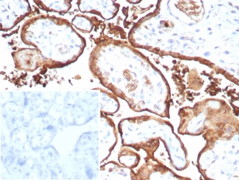 MIG9 Antibody Recombinant Rabbit MAb S100P/9135R in human placental tissue. Immunohistochemistry staining of FFPE human placenta demonstrates cytoplasmic staining in trophoblastic epithelial cells consistent with expression of migration inducing gene 9 / S100 calcium binding protein P (S100P). Brown chromogenic signal highlights S100P-positive trophoblast layers within placental villi while surrounding stromal elements show comparatively weaker staining. The inset shows PBS used in place of primary antibody as a secondary-only negative control. Heat-induced epitope retrieval was performed by boiling tissue sections in pH 9 Tris buffer with 1 mM EDTA for 20 min before staining.