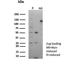 SDS-PAGE analysis of purified, BSA-free recombinant Calnexin antibody (clone CANX/9147R) as confirmation of integrity and purity.