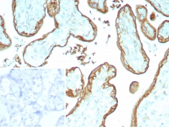 IHC staining of FFPE human placenta tissue with CD147/Basigin  antibody (clone BSG/9223R). Inset: PBS used in place of primary Ab (secondary Ab negative control). HIER: boil tissue sections in pH 9 10mM Tris with 1mM EDTA for 20 min and allow to cool before testing.