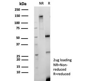 SDS-PAGE Analysis CD147/Basigin  antibody (clone BSG/9223R) as confirmation of integrity and purity.