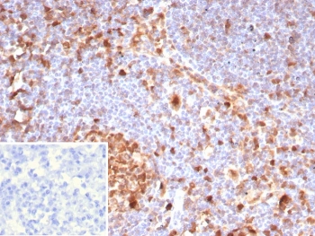 IHC staining of FFPE human lymph node tissue with Caspase 3 antibody (clone CASP3/8446). Inset: PBS used in place of primary Ab (secondary Ab negative control). HIER: boil tissue sections in pH 9 10mM Tris with 1mM EDTA for 20 min and allow to cool before testing.
