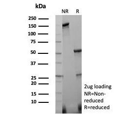 SDS-PAGE analysis of purified, BSA-free Caspase 3 antibody (clone CASP3/8446) as confirmation of integrity and purity.