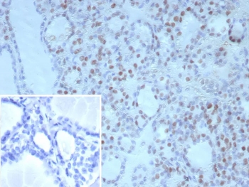 IHC staining of FFPE human thyroid tissue with NKX2.1 antibody (clone NX2.1/9030). Inset: PBS used in place of primary Ab (secondary Ab negative control). HIER: boil tissue sections in pH 9 10mM Tris with 1mM EDTA for 20 min and allow to cool before testing.