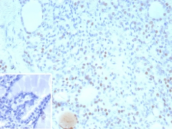 TTF-1 Antibody for IHC / TTF-1 Immunohistochemistry Antibody (clone NX2.1/9035) immunohistochemistry analysis of human thyroid tissue. Formalin-fixed, paraffin-embedded human thyroid tissue stained with mouse monoclonal clone NX2.1/9035 antibody demonstrates nuclear staining in thyroid follicular epithelial cells, consistent with the nuclear localization of Thyroid transcription factor 1 (TTF-1 / NKX2-1). The nuclear immunoreactivity highlights TTF-1 expression in follicular epithelial cells detected by immunohistochemistry in FFPE thyroid tissue sections. Inset: PBS used in place of primary antibody (secondary antibody negative control). HIER: boil tissue sections in pH 9 10mM Tris with 1mM EDTA for 20 min and allow to cool before testing.