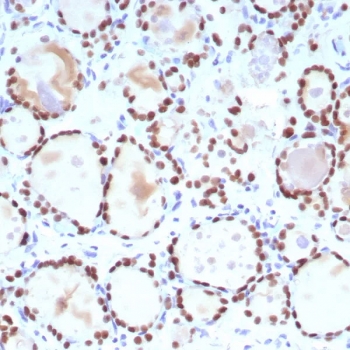 TTF-1 Antibody for IHC / TTF-1 Immunohistochemistry Antibody (clone NX2.1/9035) immunohistochemistry analysis of human thyroid tissue. Formalin-fixed, paraffin-embedded human thyroid tissue stained with mouse monoclonal clone NX2.1/9035 antibody demonstrates strong nuclear staining in thyroid follicular epithelial cells, consistent with the nuclear localization of Thyroid transcription factor 1 (TTF-1 / NKX2-1). The nuclear immunoreactivity highlights TTF-1 expression within follicular epithelial cells in FFPE thyroid tissue sections analyzed by immunohistochemistry. HIER: boil tissue sections in pH 9 10mM Tris with 1mM EDTA for 20 min and allow to cool before testing.