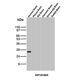 p27 Antibody Human Brain WB. Western blot analysis of p27 / CDKN1B expression across brain lysates from multiple species using p27 antibody clone KIP1/9168R. Lane 1: human brain lysate, Lane 2: mouse brain lysate, Lane 3: rat brain lysate, Lane 4: hamster brain lysate, Lane 5: guinea pig brain lysate, Lane 6: rabbit brain lysate. A band is detected at approximately 27-29 kDa in human brain lysate, consistent with the predicted molecular weight of p27 (CDKN1B), a cyclin-dependent kinase inhibitor that regulates cell cycle progression. Minimal or no detectable signal is observed in the non-human brain lysates under these conditions, supporting a human tissue-focused detection profile for this clone.