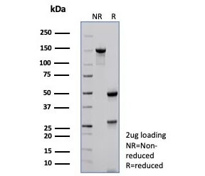 SDS-PAGE analysis of purified, BSA-free p57 antibody (clone KIP2/7639) as confirmation of integrity and purity.