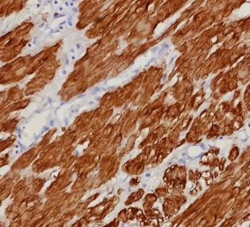 Immunohistochemistry of CNN1 Antibody in human uterus. Formalin-fixed, paraffin-embedded human uterine tissue stained with recombinant CNN1 antibody (clone rCNN1/9164) demonstrates strong cytoplasmic staining of smooth muscle cells within the myometrium, consistent with Calponin-1 expression in contractile smooth muscle fibers. Endometrial glandular epithelium shows minimal staining. Heat-induced epitope retrieval was performed by boiling tissue sections in pH 9 10mM Tris with 1mM EDTA for 20 minutes followed by cooling prior to testing.