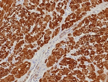 IHC staining of FFPE human uterus tissue with CNN1 antibody (clone rCNN1/9164). HIER: boil tissue sections in pH 9 10mM Tris with 1mM EDTA for 20 min and allow to cool before testing.