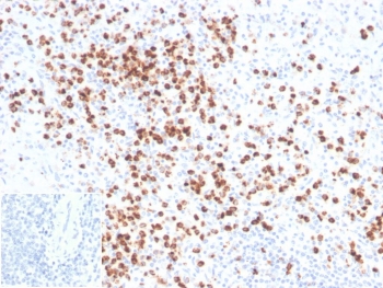 IHC staining of FFPE human spleen tissue with Lysozyme antibody (clone LYZ/3941). Inset: PBS used in place of primary Ab (secondary Ab negative control). HIER: boil tissue sections in pH 9 10mM Tris with 1mM EDTA for 20 min and allow to cool before testing.