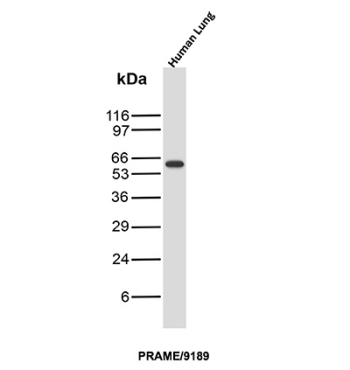 Opa-interacting Protein 4 Antibody Human Lung WB. Western blot analysis of human lung tissue lysate using Opa-interacting Protein 4 Antibody / Tumor Antigen clone PRAME/9189. A distinct band is detected at approximately 58-60 kDa, consistent with the expected molecular weight of Opa-interacting protein 4 / PRAME, a cancer-testis antigen involved in transcriptional regulation and tumor-associated immune signaling pathways. The observed signal supports expression of PRAME-associated tumor antigen pathways within human tissue-derived lysates.