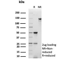 SDS-PAGE analysis of purified, BSA-free MDM2 antibody (clone MDM2/7943) as confirmation of integrity and purity.