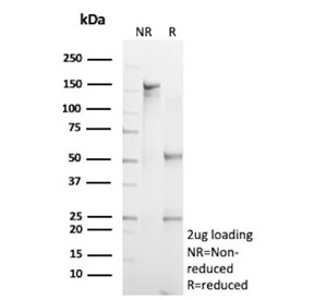SDS-PAGE analysis of purified, BSA-free recombinant FLI1 antibody (clone rFLI1/9614) as confirmation of integrity and purity.