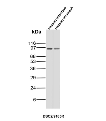 Desmocollin-2/3 Antibody Intestine and Stomach WB. Western blot analysis of human intestine and human stomach lysates using a recombinant monoclonal Desmocollin-2/3 antibody detecting DSC2 and DSC3, clone DSC2/9165R. A band is detected at approximately 95-110 kDa in both samples, consistent with the expected molecular weight of desmocollin proteins. This size range reflects glycosylation and processing typical of these desmosomal cadherins, which are key components of epithelial cell-cell adhesion complexes that maintain tissue integrity in gastrointestinal epithelium.
