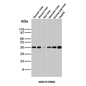 AKR1C1 Antibody Broad Species Liver WB. Western blot analysis of (1) human liver, (2) mouse liver, (3) rat liver, (4) hamster liver, (5) guinea pig liver, and (6) HepG2 cell lysates using AKR1C1 Antibody (clone AKR1C1/9062) detects a band at approximately 37 kDa across all samples, consistent with the predicted molecular weight of AKR1C1 / Aldo-keto reductase family 1 member C1. The uniform banding pattern across species supports broad cross-species reactivity and reliable detection of AKR1C1 in hepatic tissues and liver-derived cell lines, aligning with its role in steroid metabolism and detoxification pathways.