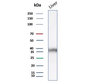 AKR1C1 Antibody Liver Tissue WB. Western blot analysis of human liver tissue lysate using AKR1C1 Antibody (clone AKR1C1/9063) detects a band at approximately 37 kDa, consistent with the predicted molecular weight of AKR1C1 / Aldo-keto reductase family 1 member C1. This band aligns with the expected size of the cytosolic enzyme and supports detection of AKR1C1 in hepatic tissue, where it functions in steroid metabolism and detoxification pathways.
