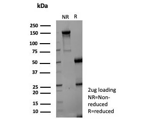 SDS-PAGE analysis of purified, BSA-free AKR1C1 antibody (clone AKR1C1/9070) as confirmation of integrity and purity.